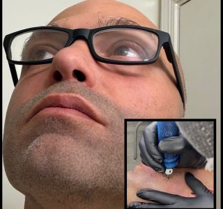 SMP treatment for man's facial hair in Upper Marlboro, MD