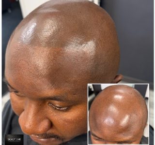 Before and After Results for a SMP procedure at Skalp Ink Micropigmentation in Maryland